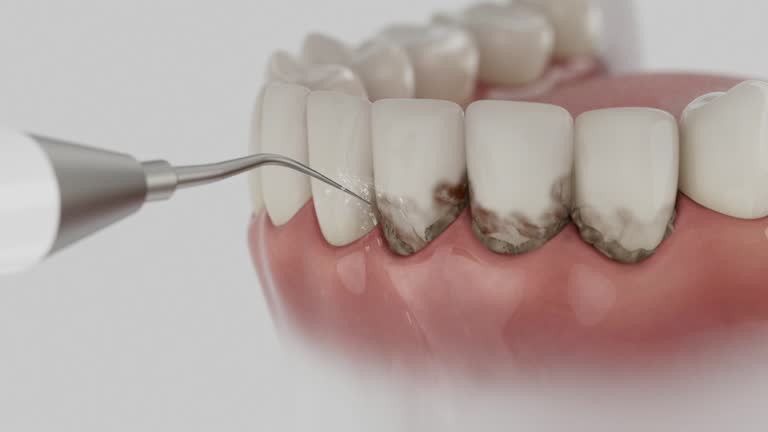 Reliable Invisalign Clear Aligners contractor in Coldwater, MI by Smile Center Dentistry